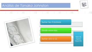 Análisis de Tanaka Johnston
 
