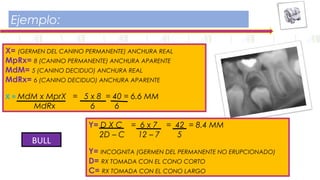 Ejemplo:
X= (GERMEN DEL CANINO PERMANENTE) ANCHURA REAL
MpRx= 8 (CANINO PERMANENTE) ANCHURA APARENTE
MdM= 5 (CANINO DECIDUO) ANCHURA REAL
MdRx= 6 (CANINO DECIDUO) ANCHURA APARENTE
X = MdM x MprX = 5 x 8 = 40 = 6.6 MM
MdRx 6 6
Y= D X C = 6 x 7 = 42 = 8.4 MM
2D – C 12 – 7 5
Y= INCOGNITA (GERMEN DEL PERMANENTE NO ERUPCIONADO)
D= RX TOMADA CON EL CONO CORTO
C= RX TOMADA CON EL CONO LARGO
BULL
 