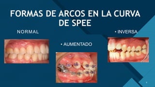 Analisis de modelos (2).pptx