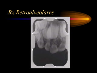 Modelo De Rx Analisis de modelos y rx | PDF