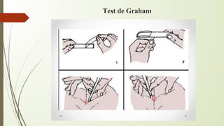 Graham Test Labcorp Analisis de muestras biologicas segun el tipo de muestras biologicas | PDF