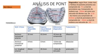 analisis de nance y pontt.pptx ortodoncia para principiantes | PPTX