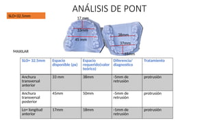 analisis de nance y pontt.pptx ortodoncia para principiantes | PPTX
