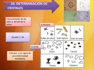 10. DETERMINACIÓN DE
CRISTALES
Concentración de las
sales y del pH de la
orina.

O Alcalina

Ayudan a Dx

O Acida
Cálculos o un signo de
una enfermedad
metabólica

 