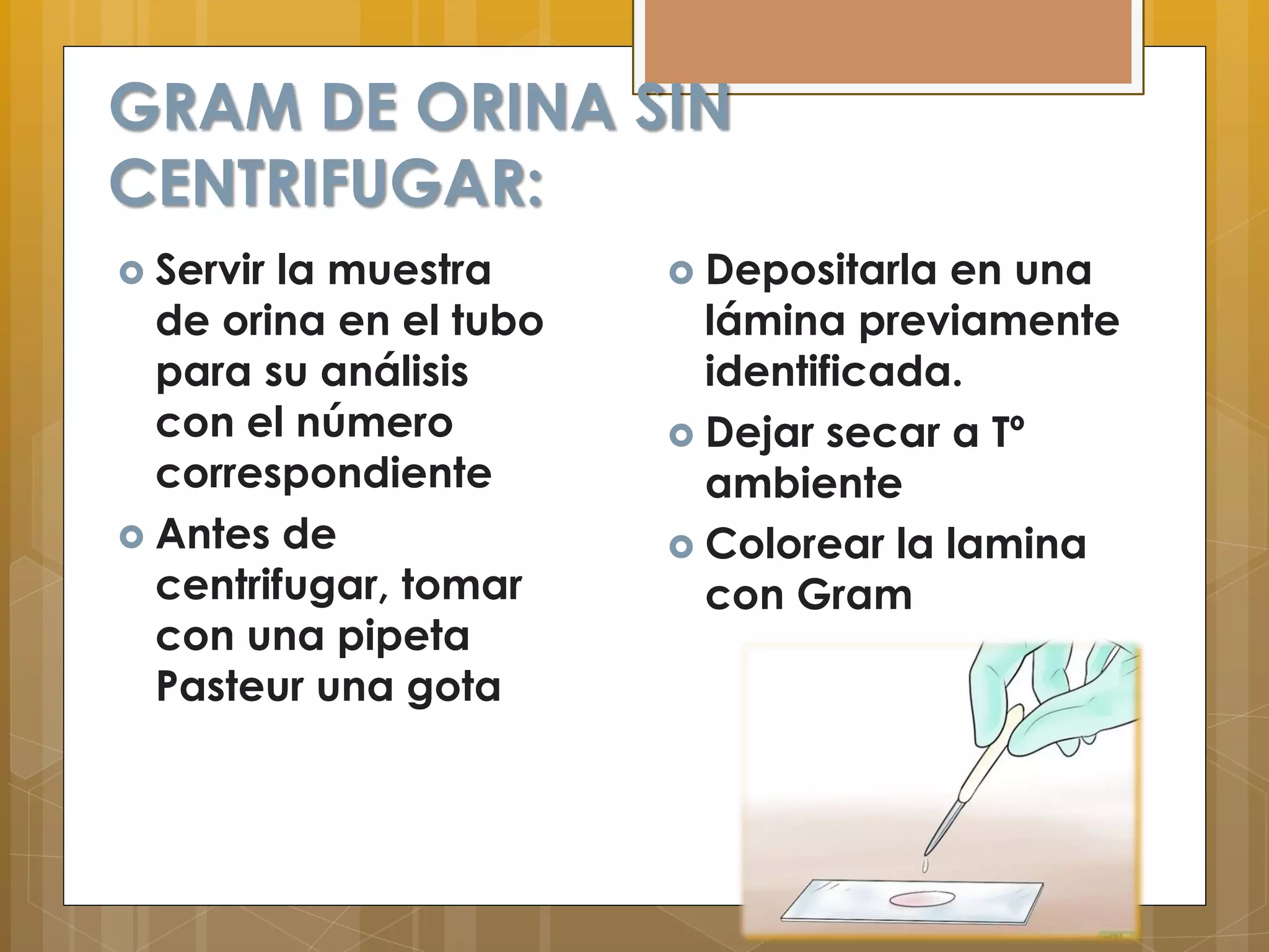 ANALISIS DE ORINA.pdf