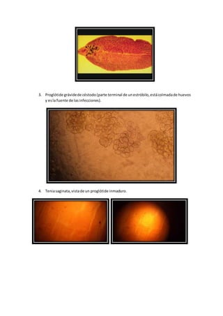 3. Proglótide grávidede céstodo(parte terminal de unestróbilo,estácolmadade huevos
y esla fuente de lasinfecciones).
4. Teniasaginata,vistade un proglótide inmaduro.
 