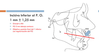 Incisivo Inferior al P. O. 1 mm ± 1,25 mm Overjet o MA PO 3 mm debajo comisura Objetivo: posición final del 1 inferior con regularización del PO 