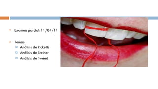 Examen parcial: 11/04/11 Temas: Análisis de Ricketts Análisis de Steiner Análisis de Tweed 