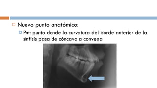 Nuevo punto anatómico: Pm: punto donde la curvatura del borde anterior de la sínfisis pasa de cóncava a convexa 