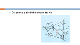 Dc: centro del cóndilo sobre Ba-Na 