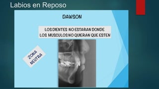 Labio Reposo Análisis de Tejidos blandos, posición natural de la cabeza.pptx