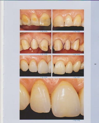 LIVRO Análise Estética: odontostation@gmail.com