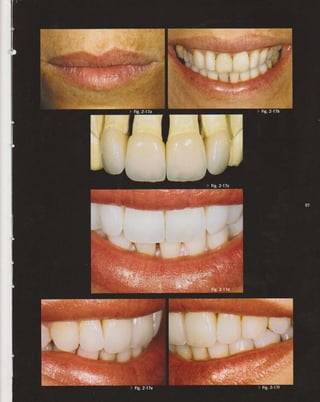 LIVRO Análise Estética: odontostation@gmail.com