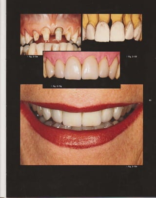 LIVRO Análise Estética: odontostation@gmail.com