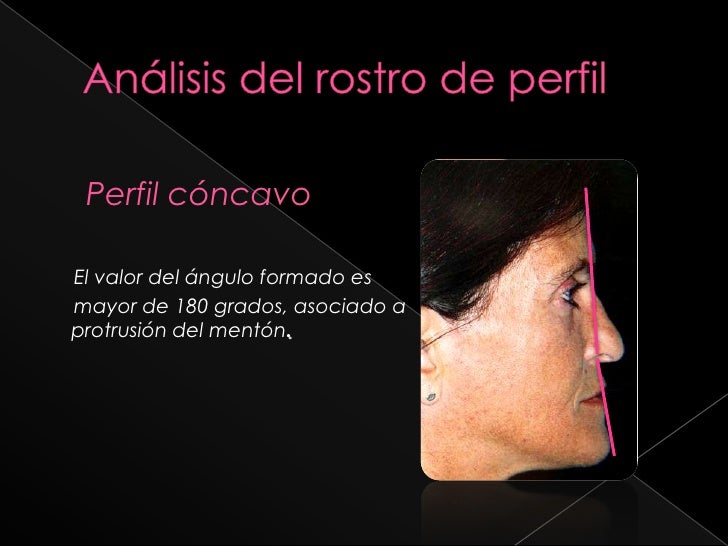 Imagenes Para Perfil Normal | analisis estetico 2010 Imagenes Para Perfil Normal | analisis estetico 2010