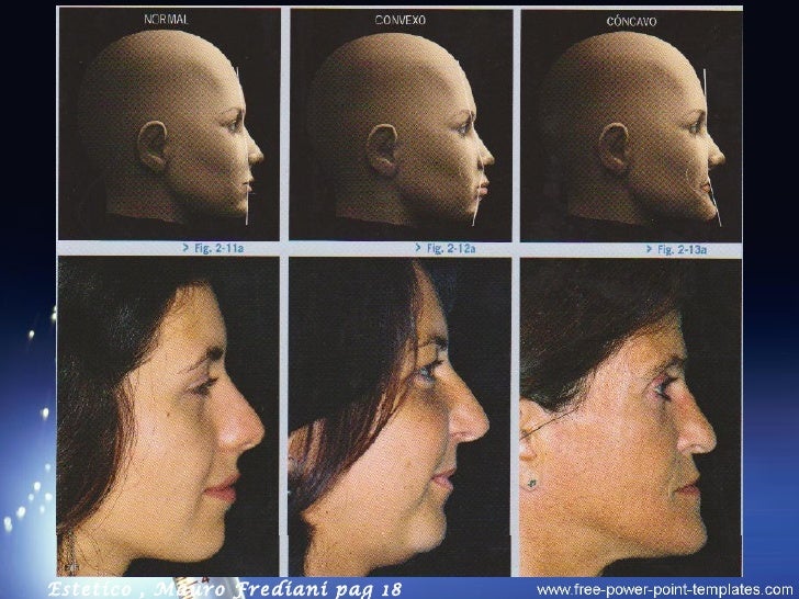 perfiles adulto facial perfiles adulto facial
