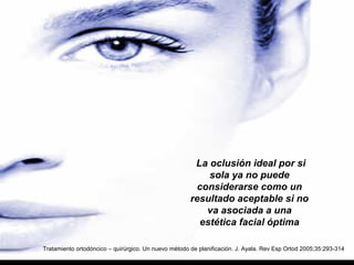 La oclusión ideal por si
sola ya no puede
considerarse como un
resultado aceptable si no
va asociada a una
estética facial óptima
Tratamiento ortodóncico – quirúrgico. Un nuevo método de planificación. J. Ayala. Rev Esp Ortod 2005;35:293-314
 