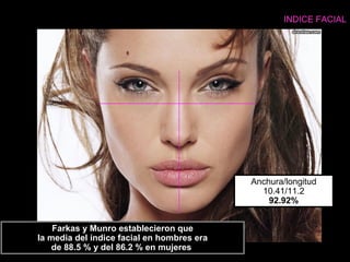 Farkas y Munro establecieron que
la media del índice facial en hombres era
de 88.5 % y del 86.2 % en mujeres
Anchura/longitud
10.41/11.2
92.92%
INDICE FACIAL
 