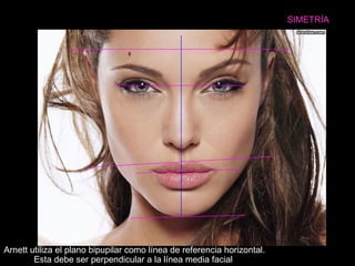 SIMETRÍA
Arnett utiliza el plano bipupilar como línea de referencia horizontal.
Esta debe ser perpendicular a la línea media facial
 