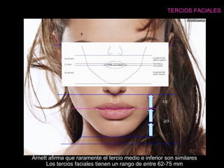 1/3
2/3
TERCIOS FACIALES
Arnett afirma que raramente el tercio medio e inferior son similares
Los tercios faciales tienen un rango de entre 62-75 mm
 