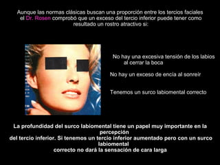No hay una excesiva tensión de los labios
al cerrar la boca
No hay un exceso de encía al sonreír
Tenemos un surco labiomental correcto
Aunque las normas clásicas buscan una proporción entre los tercios faciales
el Dr. Rosen comprobó que un exceso del tercio inferior puede tener como
resultado un rostro atractivo si:
La profundidad del surco labiomental tiene un papel muy importante en la
percepción
del tercio inferior. Si tenemos un tercio inferior aumentado pero con un surco
labiomental
correcto no dará la sensación de cara larga
 