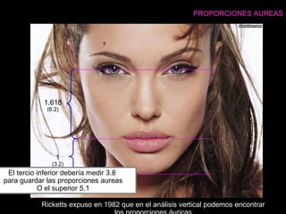 PROPORCIONES AUREAS
El tercio inferior debería medir 3.8
para guardar las proporciones aureas
O el superior 5.1
1.618
(6.2)
1
(3.2)
Ricketts expuso en 1982 que en el análisis vertical podemos encontrar
 