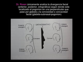 Dr. Rosen únicamente analiza la divergencia facial
(anterior, posterior, ortognática) según donde este
localizado el pogonion en una perpendicular que
pase por glabela y la convexidad o concavidad
facial (glabela-subnasal-pogonion)
 