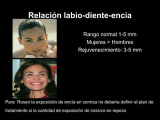 Relación labio-diente-encia
Para Rosen la exposición de encía en sonrisa no debería definir el plan de
tratamiento si la cantidad de exposición de incisivo en reposo
Rango normal 1-5 mm
Mujeres > Hombres
Rejuvenecimiento: 3-5 mm
 
