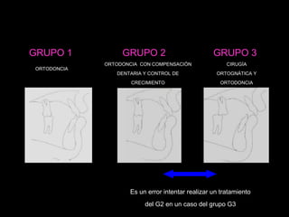 GRUPO 1 GRUPO 2 GRUPO 3
ORTODONCIA
ORTODONCIA CON COMPENSACIÓN
DENTARIA Y CONTROL DE
CRECIMIENTO
CIRUGÍA
ORTOGNÁTICA Y
ORTODONCIA
Es un error intentar realizar un tratamiento
del G2 en un caso del grupo G3
 