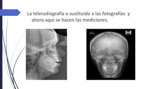 La teleradiografía a sustituido a las fotografías y
ahora aquí se hacen las mediciones.
 
