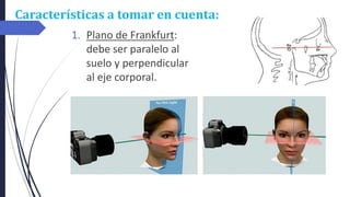 Características a tomar en cuenta:
1. Plano de Frankfurt:
debe ser paralelo al
suelo y perpendicular
al eje corporal.
 