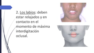 2. Los labios: deben
estar relajados y en
contacto en el
momento de máxima
interdigitación
oclusal.
 