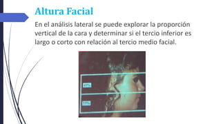 Altura Facial
En el análisis lateral se puede explorar la proporción
vertical de la cara y determinar si el tercio inferior es
largo o corto con relación al tercio medio facial.
 