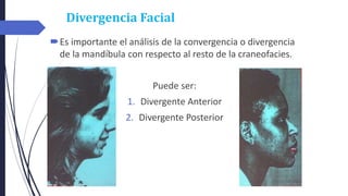 Divergencia Facial
Es importante el análisis de la convergencia o divergencia
de la mandíbula con respecto al resto de la craneofacies.
Puede ser:
1. Divergente Anterior
2. Divergente Posterior
 