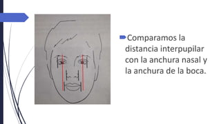 Comparamos la
distancia interpupilar
con la anchura nasal y
la anchura de la boca.
 