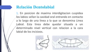 Relación Dentolabial
1. En posicion de maxima interdigitacion cuspidea
los labios sellan la cavidad oral entrando en contacto
a lo largo de una linea a la que se denomina Linea
Labial. Esta linea debe quedar situada a un
determinado nivel vertical con relacion a la cara
labial de los incisivos.
 