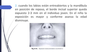2. cuando los labios están entreabiertos y la mandíbula
en posición de reposo, el borde incisal superior queda
expuesto 2-3 mm en el individuo joven. En el niño la
exposición es mayor y conforme avanza la edad
disminuye.
 