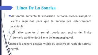 Línea De La Sonrisa
Al sonreír aumenta la exposición dentaria. Deben cumplirse
ciertos requisitos para que la sonrisa sea estéticamente
aceptable:
1. El labio superior al sonreír queda por encima del limite
dentario exhibiendo 2-3 mm del margen gingival.
Cuando la anchura gingival visible es excesiva se habla de sonrisa
gingival.
 