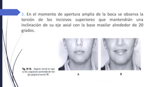 3. En el momento de apertura amplia de la boca se observa la
torsión de los incisivos superiores que mantendrán una
inclinación de su eje axial con la base maxilar alrededor de 20
grados.
 