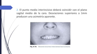 2. El punto medio interincisivo deberá coincidir con el plano
sagital medio de la cara. Desviaciones superiores a 1mm
producen una asimetría aparente.
 