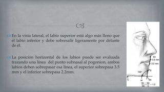
 En la vista lateral, el labio superior está algo más lleno que
el labio inferior y debe sobresalir ligeramente por delante
de él.
 La posición horizontal de los labios puede ser evaluada
trazando una línea del punto subnasal al pogonion, ambos
labios deben sobrepasar esa línea, el superior sobrepasa 3.5
mm y el inferior sobrepasa 2.2mm.
 