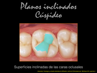 Planos inclinados
Cúspideo
Superﬁcies inclinadas de las caras oclusales
Anatomía, fisiología y oclusión dentales de Wheeler; editorial Interamerican McGraw-Hill: capitulo 6
 