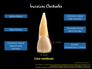 Incisivos Centrales
Cara vestibular
10 - 11 mm
8 - 9 mm
Raíz cónica
Apice Romo
Contorno mesial
ligeramente
convexo
Contorno distal
mas convexo
Cervical: forma
semi-circular
Incisal:
mamelones o rectos
Anatomía, fisiología y oclusión dentales de Wheeler; editorial Interamerican McGraw-Hill: capitulo 6
Photo: BoneBox - Dental Lite
Desafiando la Naturales, Paulo kano; editorial Quintessence; capitulo 1 y 2
Pascal Magne, A new approach to the learningof dental morphology, function, and esthetics: the “2D-3D-4D” concep
 
 