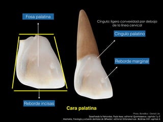 Cara palatina
Cíngulo palatino
Reborde marginal
Fosa palatina
Reborde incisas
Cíngulo: ligero convexidad por debajo
de la línea cervical
Anatomía, fisiología y oclusión dentales de Wheeler; editorial Interamerican McGraw-Hill: capitulo 6
Photo: BoneBox - Dental Lite
Desafiando la Naturales, Paulo kano; editorial Quintessence; capitulo 1 y 2
 