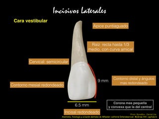 Incisivos Laterales
Cara vestibular
9 mm
6.5 mm
Corona mas pequeña
y convexa que la del central
Raíz recta hasta 1/3
medio, con curva amical
Apice puntiaguado
Contorno mesial redondeado
Cervical: semicircular
Incisal redondeado
Contorno distal y ángulos
mas redondeado
Anatomía, fisiología y oclusión dentales de Wheeler; editorial Interamerican McGraw-Hill: capitulo 6
Photo: BoneBox - Dental Lite
 