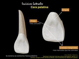 Cara palatina
Cingulo
Crestas marginales
Fosa
mas marcadas que los centrales
Incisivos Laterales
más cóncava
la corona se estrecha hacia palatino
Anatomía, fisiología y oclusión dentales de Wheeler; editorial Interamerican McGraw-Hill: capitulo 6
Photo: BoneBox - Dental Lite
Desafiando la Naturales, Paulo kano; editorial Quintessence; capitulo 1 y 2
 