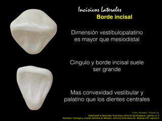 Borde incisal
Incisivos Laterales
Dimensión vestíbulopalatino
es mayor que mesiodistal
Mas convexidad vestibular y
palatino que los dientes centrales
Cingulo y borde incisal suele
ser grande
Anatomía, fisiología y oclusión dentales de Wheeler; editorial Interamerican McGraw-Hill: capitulo 6
Photo: BoneBox - Dental Lite
Desafiando la Naturales, Paulo kano; editorial Quintessence; capitulo 1 y 2
 