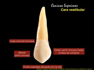 Cara vestibular
Caninos Superiores
Linea cervical convexa
Mesial
perﬁl convexo
Distal: perﬁl cóncavo hasta
el área de contacto
Punta cúspidea alineada con la raíz
Anatomía, fisiología y oclusión dentales de Wheeler; editorial Interamerican McGraw-Hill: capitulo 6
 