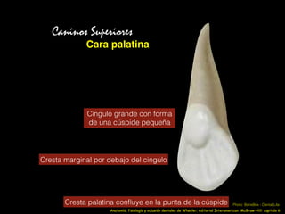 Cara palatina
Caninos Superiores
Cingulo grande con forma
de una cúspide pequeña
Cresta marginal por debajo del cingulo
Cresta palatina conﬂuye en la punta de la cúspide
Anatomía, fisiología y oclusión dentales de Wheeler; editorial Interamerican McGraw-Hill: capitulo 6
Photo: BoneBox - Dental Lite
 