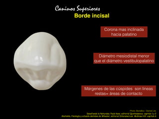 Borde incisal
Caninos Superiores
Corona mas inclinada
hacia palatino
Márgenes de las cúspides son lineas
restas= áreas de contacto
Diámetro mesiodistal menor
que el diámetro vestibulopalatino
Anatomía, fisiología y oclusión dentales de Wheeler; editorial Interamerican McGraw-Hill: capitulo 6
Photo: BoneBox - Dental Lite
Desafiando la Naturales, Paulo kano; editorial Quintessence; capitulo 1 y 2
 